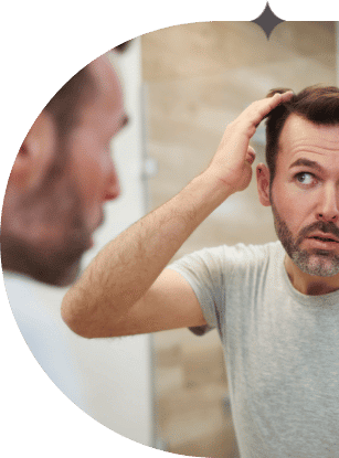 A man with graying beard examines his receding hair line in the mirror and considers hair restoration