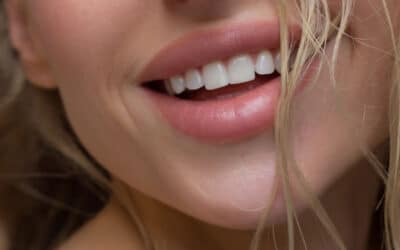 6 Ways Lip Fillers Enhance More Than Just Your Smile [Infographic]