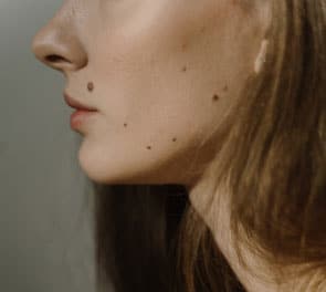 Closeup of woman's clear, glowing skin