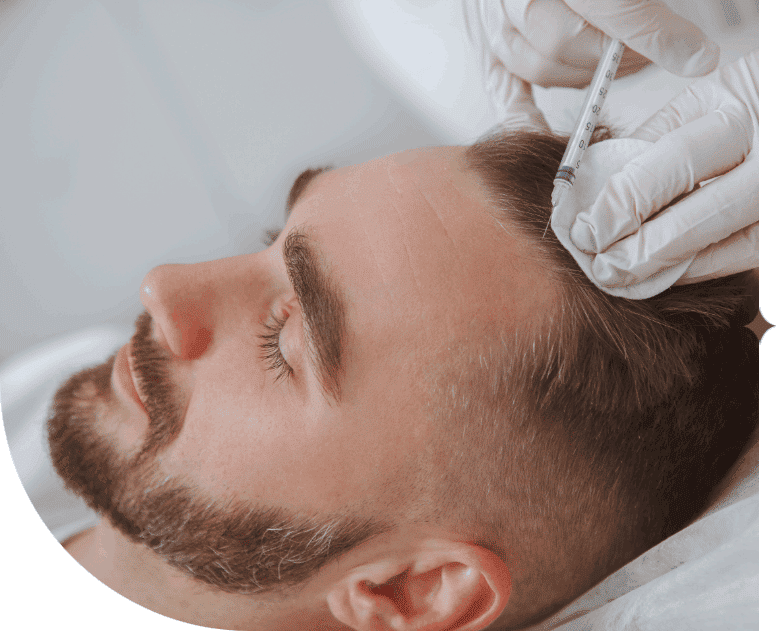 Gloved hands inject a male's hairline with PRP for men's hair restoration
