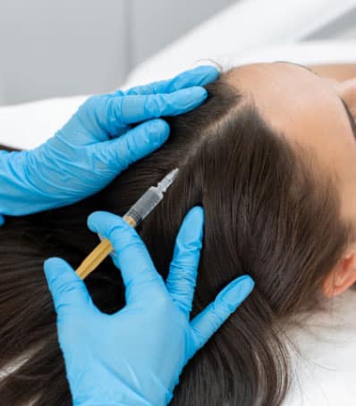 Gloved hands inject platelet-rich-plasma into a woman's hairline for hair restoration