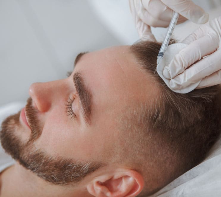 Man gets PRP hair restoration injection on his scalp