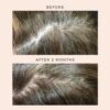 Wholy Dose Supplement Mix Collagen Unflavored Hair results, showing a before and after two months pictures of the part in someone's hair with noticably improved hair growth