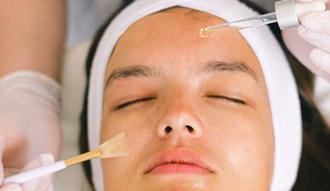 A woman receives a chemical peel facial