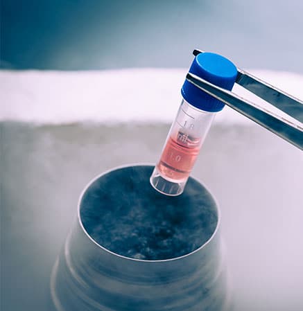 Liquid Nitrogen bank containing suspension of stem cells for IV Therapy